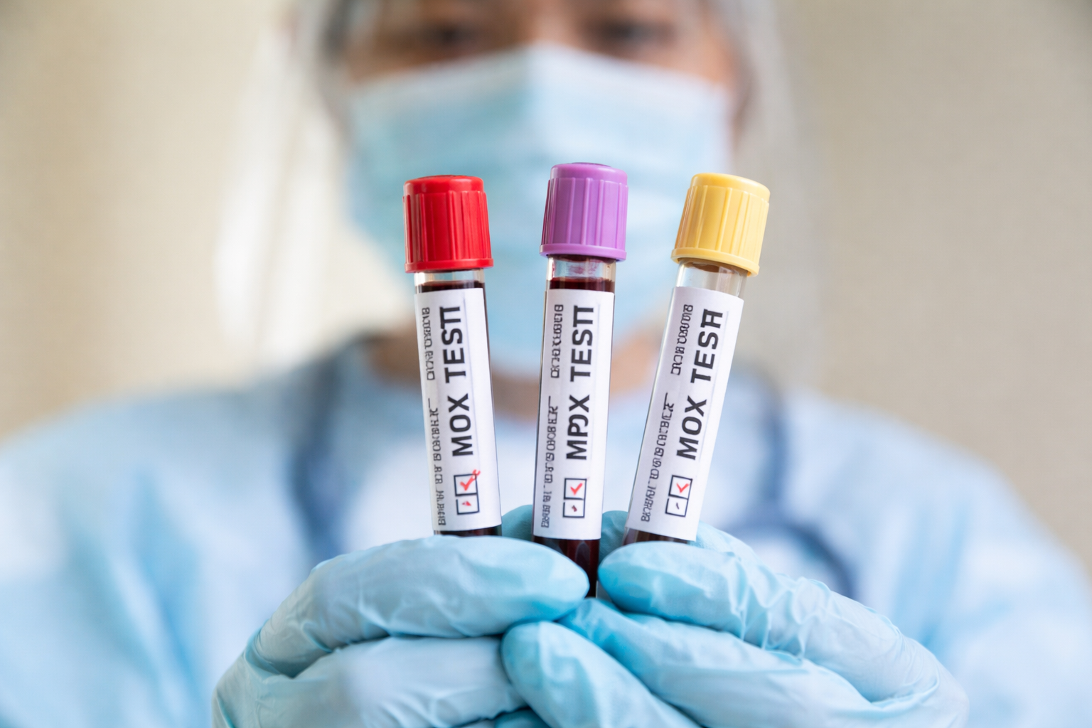 Brasil registra ao menos 62 casos de mpox nos primeiros meses de 2026